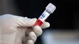 Alhamdulillah! 10 Juta Vaksin Corona Halal Didapat RI dari Uni Emirat Arab