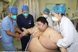 Seorang Pria di Wuhan dengan Berat Badan Naik 101 Kg Selama Pandemi