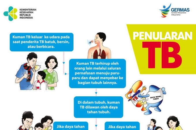 Dinas Kesehatan Kabupaten Indragiri Hilir Tingkatkan Pelayanan Kesehatan untuk Orang Terduga Tuberkulosis